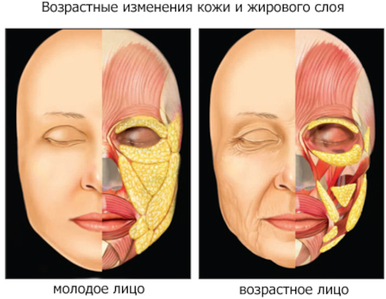 Круглое лицо у девушки. Как исправить, вытянуть, убрать щеки